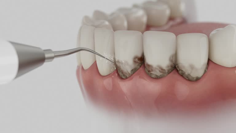 Reliable Dental Implants contractor in Pisgah, AL by Smile Center Dentistry